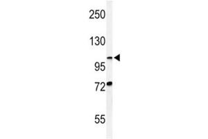 Western blot analysis of HIF1 alpha antibody and CHO lysate