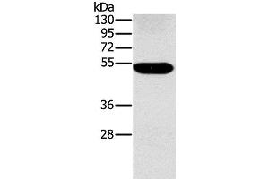 Western Blot analysis of Human placenta tissue using FUCA1 Polyclonal Antibody at dilution of 1:500 (FUCA1 anticorps)