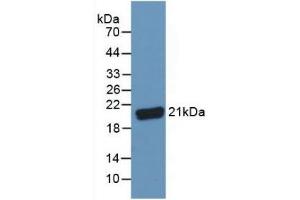 Detection of C8g in Human Serum using Polyclonal Antibody to Complement Component 8g (C8g)
