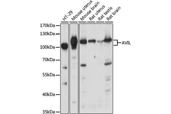 Advillin Antikörper  (AA 470-819)
