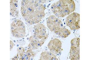 Immunohistochemistry of paraffin-embedded Human stomach using RAPSN Polyclonal Antibody at dilution of 1:100 (40x lens).