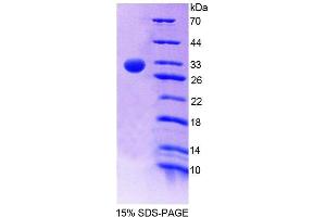 SDS-PAGE analysis of Human RUNX1 Protein.
