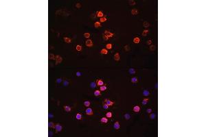 Immunofluorescence analysis of THP-1 cells using IL1β antibody (ABIN6128125, ABIN6142334, ABIN6142337 and ABIN6215185) at dilution of 1:100. (IL-1 beta anticorps  (AA 124-223))