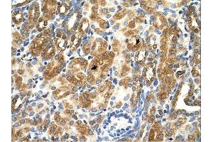 MAS1 antibody was used for immunohistochemistry at a concentration of 4-8 ug/ml. (MAS1 anticorps  (Middle Region))