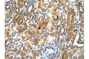 MAS1 antibody was used for immunohistochemistry at a concentration of 4-8 ug/ml.