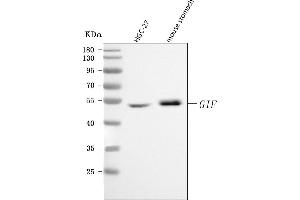 Western blot analysis of CBLIF using anti-CBLIF antibody (ABIN7599904). (CBLIF (AA 128-417) anticorps)