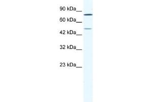 WB Suggested Anti-ZNF12 Antibody Titration:  1. (ZNF12 anticorps  (N-Term))