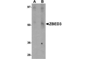 Western blot analysis of ZBED3 in rat lung tissue lysate with this product at (A) 1 and (B) 2 μg/ml. (ZBED3 anticorps  (N-Term))