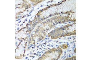 Immunohistochemistry of paraffin-embedded human stomach using ADH1C antibody (ABIN5997202) at dilution of 1/100 (40x lens). (ADH1C anticorps)