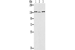 Gel: 6 % SDS-PAGE, Lysate: 40 μg, Lane 1-3: Hela cells, 231 cells, A172 cells, Primary antibody: ABIN7130904(RNF40 Antibody) at dilution 1/400, Secondary antibody: Goat anti rabbit IgG at 1/8000 dilution, Exposure time: 1 minute (RNF4 anticorps)