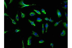 Immunofluorescence staining of U251 cells with ABIN7146077 at 1:250, counter-stained with DAPI.