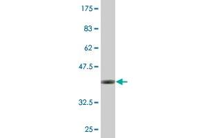 Western Blot detection against Immunogen (36. (EXOSC4 anticorps  (AA 1-100))