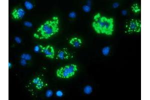 Anti-MYD88 mouse monoclonal antibody (ABIN2453996) immunofluorescent staining of COS7 cells transiently transfected by pCMV6-ENTRY MYD88 (RC202253). (MYD88 anticorps)