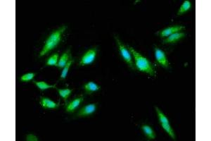 Immunofluorescence staining of Hela cells with ABIN7146907 at 1:100, counter-stained with DAPI.