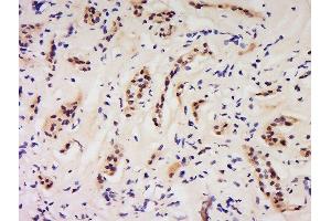 Formalin-fixed and paraffin embedded human kidney labeled with Anti-GSS/Glutathione Synthetase Polyclonal Antibody, Unconjugated  at 1:200 followed by conjugation to the secondary antibody and DAB staining. (Glutathione Synthetase anticorps  (AA 81-160))