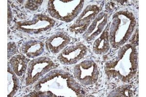 Image no. 3 for anti-Epoxide Hydrolase 1, Microsomal (Xenobiotic) (EPHX1) (AA 21-230) antibody (ABIN1491197)