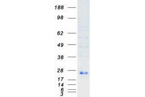 Validation with Western Blot