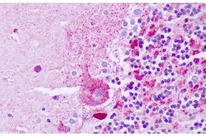 Image no. 1 for anti-Tumor Necrosis Factor Receptor Superfamily, Member 10b (TNFRSF10B) antibody (ABIN1502672)