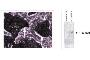 Immunohistochemistry (IHC) image for anti-Matrix Metallopeptidase 9 (Gelatinase B, 92kDa Gelatinase, 92kDa Type IV Collagenase) (MMP9) (active), (N-Term) antibody (ABIN264508) (MMP 9 anticorps  (active, N-Term))
