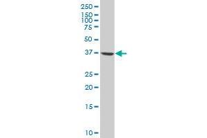 PPP2R4 polyclonal antibody (A01), Lot # 051212JC01 Western Blot analysis of PPP2R4 expression in HL-60 .