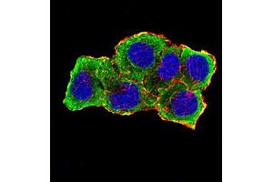 Immunofluorescence analysis of SMMC-7721 cells using AURKA mouse mAb (green).