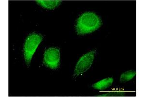 Immunofluorescence of monoclonal antibody to CLCN6 on HeLa cell. (CLCN6 anticorps  (AA 770-868))