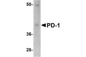Western Blotting (WB) image for anti-Programmed Cell Death 1 (PDCD1) antibody (ABIN1031790)