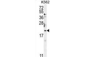 Western Blotting (WB) image for anti-BTG Family, Member 2 (BTG2) antibody (ABIN5015174) (BTG2 anticorps)