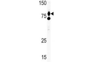 HGF antibody used in western blot to detect HGF in Ramos lysate.