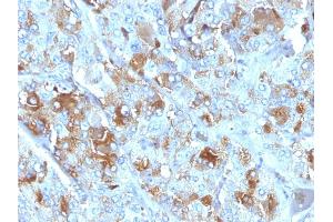 Formalin-fixed, paraffin-embedded human Adrenal Gland stained with Chromogranin A Mouse Monoclonal Antibody (CHGA/777) (Chromogranin A anticorps)