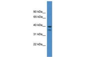 Image no. 1 for anti-serpin Peptidase Inhibitor, Clade B (Ovalbumin), Member 6 (SERPINB6) (AA 161-210) antibody (ABIN6745378) (SERPINB6 anticorps  (AA 161-210))