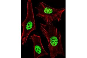 Fluorescent image of Hela cells stained with ARA Antibody (ABIN1944858 and ABIN2838532). (PPARA anticorps  (AA 1-468))