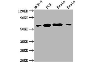 Western Blot Positive WB detected in: MCF-7 whole cell lysate, PC3 whole cell lysate, Mouse brain tissue, Rat brain tissue All lanes: LOXL2 antibody at 1:2000 Secondary Goat polyclonal to rabbit IgG at 1/50000 dilution Predicted band size: 87 kDa Observed band size: 53 kDa (Recombinant LOXL2 anticorps)