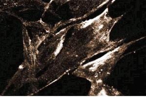Immunoflurorescence staining of FHs cells (Normal human fetal lung fibroblasts, ATCC HTB-157).