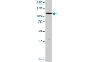 ADAMTS17 monoclonal antibody (M01), clone 3B7 Western Blot analysis of ADAMTS17 expression in A-431 .