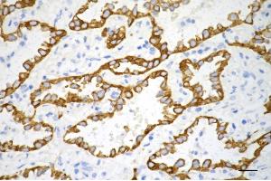 anti-Keratin 7 (KRT7) antibody