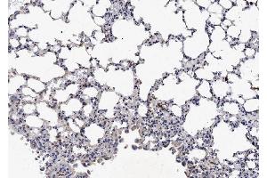 IHC analysis of NCR1 using anti-NCR1 antibody (ABIN5693031).