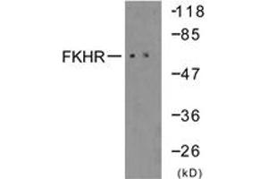 Western blot analysis of extracts from 293 cells, treated with serum 10% 15', using FKHR (Ab-319) Antibody. (FOXO1 anticorps  (AA 286-335))