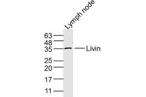 Mouse Lymph node lysates probed with Livin Polyclonal Antibody, Unconjugated  at 1:300 dilution and 4˚C overnight incubation. (BIRC7 anticorps  (AA 101-200))
