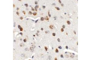 Immunohistochemistry of CHD7 in mouse brain tissue with CHD7 antibody at 5 ug/mL.