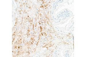 Immunohistochemistry (IHC) image for anti-Ubiquitin Carboxyl-terminal Esterase L1 (Ubiquitin Thiolesterase) (UCHL1) (AA 50-100) antibody (ABIN7449527)