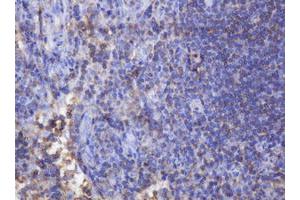 Image no. 2 for anti-Fibronectin Type III Domain Containing 4 (FNDC4) antibody (ABIN1498289)