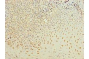Immunohistochemistry of paraffin-embedded human tonsil tissue using ABIN7175990 at dilution of 1:100 (ZBTB6 anticorps  (AA 115-424))