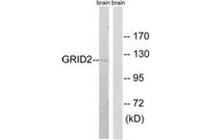 Western blot analysis of extracts from mouse brain cells, using GRID2 Antibody.