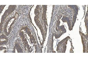 IHC analysis of YTHDF2 using anti-YTHDF2 antibody (ABIN7603191). (YTHDF2 anticorps  (N-Term))