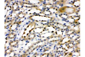 Alpha Actinin 4 was detected in paraffin-embedded sections of rat kidney tissues using rabbit anti- Alpha Actinin 4 Antigen Affinity purified polyclonal antibody (Catalog # ) at 1 µg/mL.