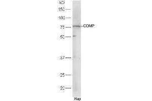 Raji cell lysates probed with Rabbit Anti-COMP Polyclonal Antibody, Unconjugated (ABIN2559644) at 1:300 in 4˚C. (COMP anticorps  (AA 221-320))