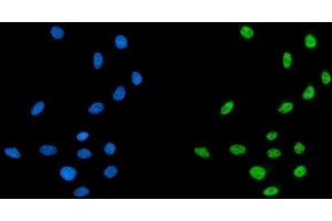IF analysis of CPSF6 using anti-CPSF6 antibody (ABIN7601898).