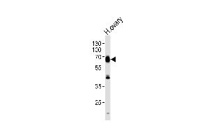 Western blot analysis of lysate from human ovary tissue lysate, using RYK Antibody  (ABIN392050 and ABIN2841818).