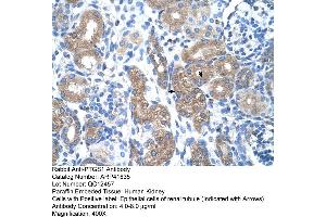 Rabbit Anti-PTGS1 Antibody  Paraffin Embedded Tissue: Human Kidney Cellular Data: Epithelial cells of renal tubule Antibody Concentration: 4. (PTGS1 anticorps  (N-Term))